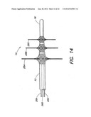 METHODS OF USING A CATHETER HAVING A BRAIDED CONDUCTIVE MEMBER diagram and image