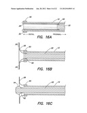 METHODS OF USING A CATHETER HAVING A BRAIDED CONDUCTIVE MEMBER diagram and image