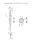 METHODS OF USING A CATHETER HAVING A BRAIDED CONDUCTIVE MEMBER diagram and image