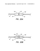 METHODS OF USING A CATHETER HAVING A BRAIDED CONDUCTIVE MEMBER diagram and image