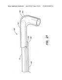 METHODS OF USING A CATHETER HAVING A BRAIDED CONDUCTIVE MEMBER diagram and image