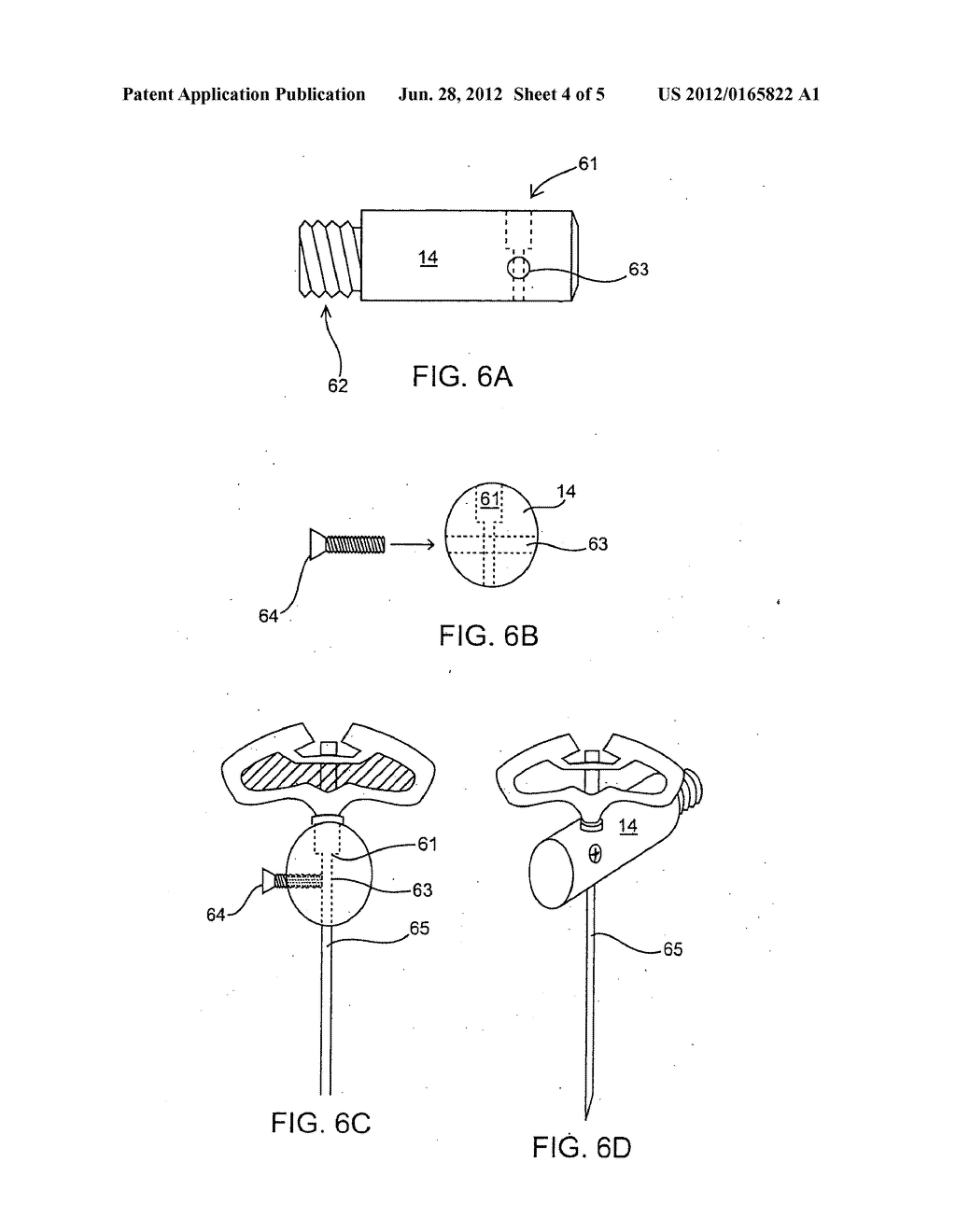 Use of Vibration in Composite Fixation - diagram, schematic, and image 05