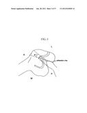 METHOD AND SYSTEM FOR CUTTING KNEE JOINT USING ROBOT diagram and image