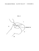 METHOD AND SYSTEM FOR CUTTING KNEE JOINT USING ROBOT diagram and image