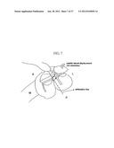 METHOD AND SYSTEM FOR CUTTING KNEE JOINT USING ROBOT diagram and image