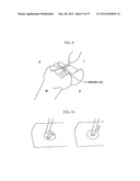 METHOD AND SYSTEM FOR CUTTING KNEE JOINT USING ROBOT diagram and image