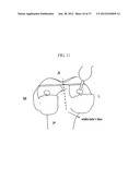 METHOD AND SYSTEM FOR CUTTING KNEE JOINT USING ROBOT diagram and image