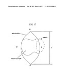 METHOD AND SYSTEM FOR CUTTING KNEE JOINT USING ROBOT diagram and image