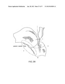 METHOD AND SYSTEM FOR CUTTING KNEE JOINT USING ROBOT diagram and image