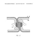 SINGLE FOLD DEVICE FOR TISSUE FIXATION diagram and image