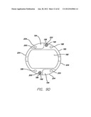 SINGLE FOLD DEVICE FOR TISSUE FIXATION diagram and image