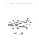 SINGLE FOLD DEVICE FOR TISSUE FIXATION diagram and image