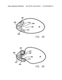 SINGLE FOLD DEVICE FOR TISSUE FIXATION diagram and image