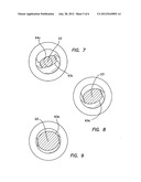 BLUNT TIP OBTURATOR diagram and image