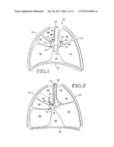 REMOVABLE ANCHORED LUNG VOLUME REDUCTION DEVICES AND METHODS diagram and image