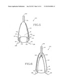 REMOVABLE ANCHORED LUNG VOLUME REDUCTION DEVICES AND METHODS diagram and image