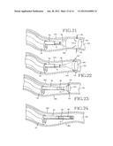 REMOVABLE ANCHORED LUNG VOLUME REDUCTION DEVICES AND METHODS diagram and image