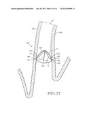 REMOVABLE ANCHORED LUNG VOLUME REDUCTION DEVICES AND METHODS diagram and image