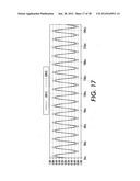 MEDICAL DEVICE WITH AN ELECTRICALLY CONDUCTIVE ANTI-ANTENNA MEMBER diagram and image