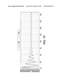 MEDICAL DEVICE WITH AN ELECTRICALLY CONDUCTIVE ANTI-ANTENNA MEMBER diagram and image