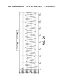 MEDICAL DEVICE WITH AN ELECTRICALLY CONDUCTIVE ANTI-ANTENNA MEMBER diagram and image