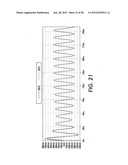 MEDICAL DEVICE WITH AN ELECTRICALLY CONDUCTIVE ANTI-ANTENNA MEMBER diagram and image