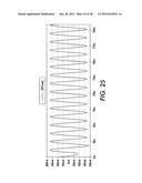 MEDICAL DEVICE WITH AN ELECTRICALLY CONDUCTIVE ANTI-ANTENNA MEMBER diagram and image