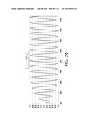 MEDICAL DEVICE WITH AN ELECTRICALLY CONDUCTIVE ANTI-ANTENNA MEMBER diagram and image