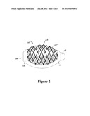 CEMENT-DIRECTING ORTHOPEDIC IMPLANTS diagram and image