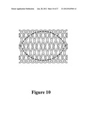 CEMENT-DIRECTING ORTHOPEDIC IMPLANTS diagram and image