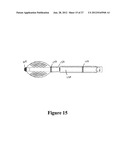 CEMENT-DIRECTING ORTHOPEDIC IMPLANTS diagram and image