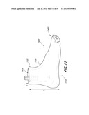 FUNCTIONAL FOOT COVER diagram and image