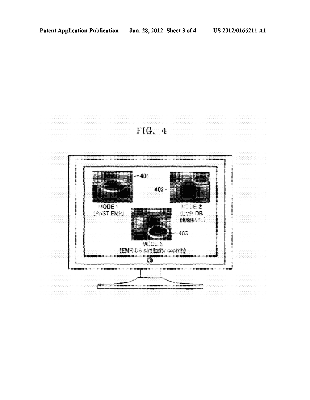 METHOD AND APPARATUS FOR AIDING IMAGING DIAGNOSIS USING MEDICAL IMAGE, AND     IMAGE DIAGNOSIS AIDING SYSTEM FOR PERFORMING THE METHOD - diagram, schematic, and image 04