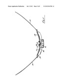 Adjustable and Vented Apparel Closure Assembly diagram and image