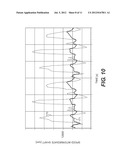 SUPERCHARGED ENGINE diagram and image