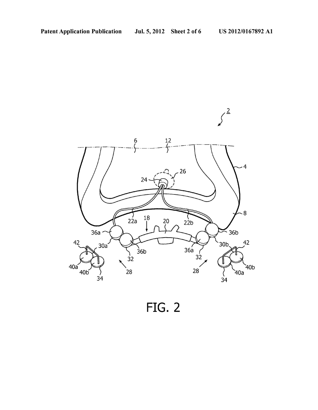 PATIENT INTERFACE DEVICE INCLUDING A MECHANISM FOR MANIPULATING THE     POSITION OF AN INTERNAL COMPONENT THEREOF - diagram, schematic, and image 03