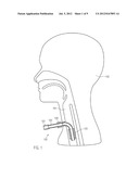Tracheostomy Tube Having a Sealing Device diagram and image