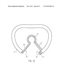 Tracheostomy Tube Having a Sealing Device diagram and image