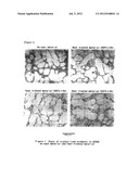 ALUMINUM ALLOY CASTING MATERIAL FOR HEAT TREATMENT EXCELLING IN HEAT     CONDUCTION AND PROCESS FOR PRODUCING THE SAME diagram and image