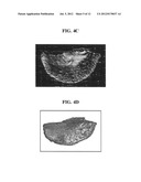 Apparatus for imaging a tissue region diagram and image