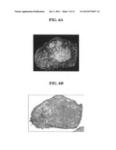 Apparatus for imaging a tissue region diagram and image