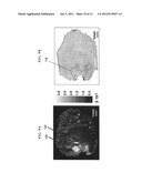 Apparatus for imaging a tissue region diagram and image