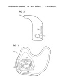 HEARING AID WITH WIRELESS BATTERY CHARGING CAPABILITY diagram and image