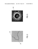 SYNCHRONIZATION OF MEDICAL IMAGING SYSTEMS diagram and image