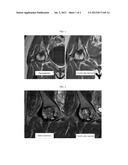 COMPOSITIONS AND METHODS FOR TREATING, PREVENTING, OR ALLEVIATING BONE OR     CARTILAGE DISEASES diagram and image