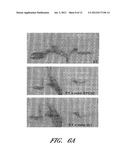 MONOCLONAL ANTIBODIES THAT NEUTRALIZE ANTHRAX TOXINS diagram and image