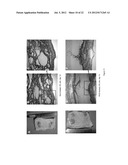 SILK FIBROIN HYDROGELS AND USES THEREOF diagram and image