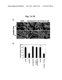 METHODS AND COMPOSITIONS FOR THE TREATMENT AND DIAGNOSIS OF STATIN-INDUCED     MYOPATHY diagram and image