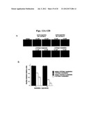 METHODS AND COMPOSITIONS FOR THE TREATMENT AND DIAGNOSIS OF STATIN-INDUCED     MYOPATHY diagram and image