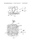 TUFTED FIBROUS WEB diagram and image